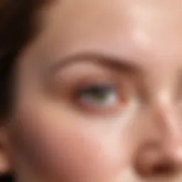 Close-up of acne on forehead
