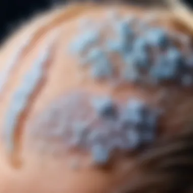 Scalp condition under a microscope