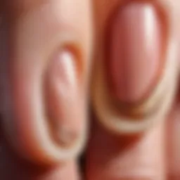 Illustration of nail cuticles showcasing their structure